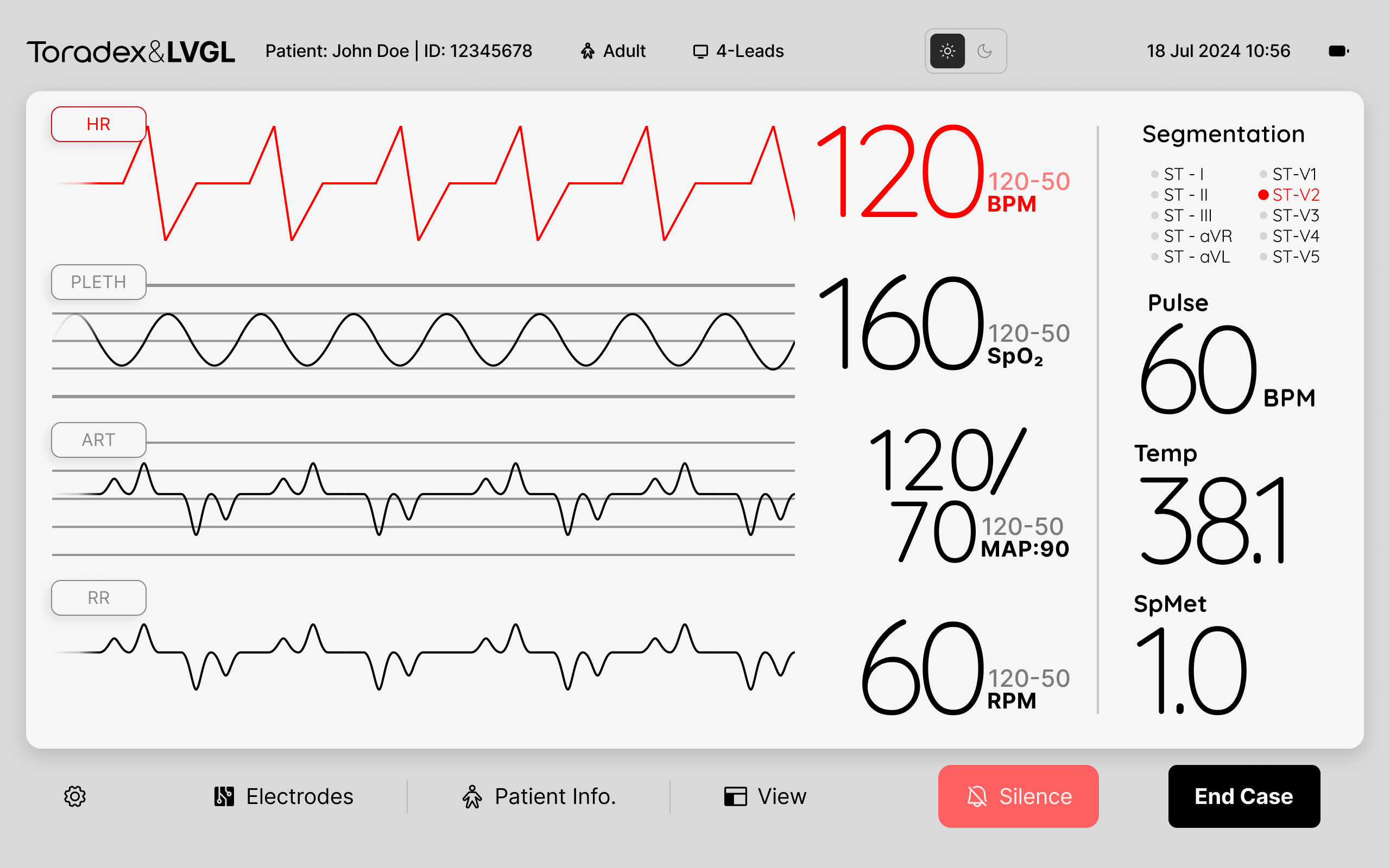 #12-leads- Ful HD Touch – 1280×800