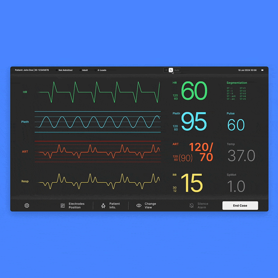 ecg-gif-herosection